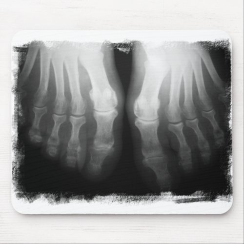 X_Ray Feet Human Skeleton Bones Black  White Mouse Pad