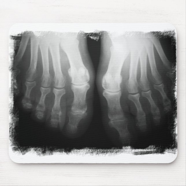 X-Ray Feet Human Skeleton Bones Black & White Mouse Pad (Front)