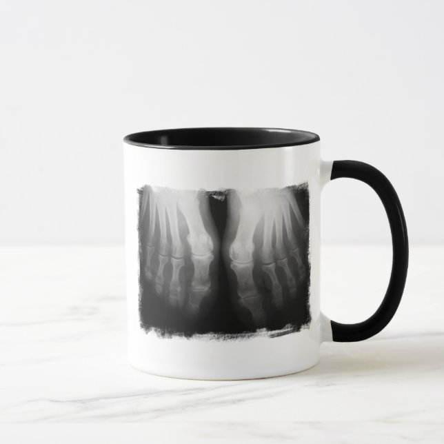 X-Ray Feet Human Skeleton Bones Black & White Mug (Right)