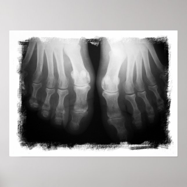 X-Ray Feet Human Skeleton Bones Black & White Poster (Front)
