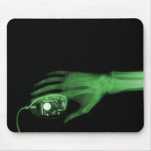 X-Ray Hand & Computer Mouse