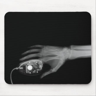 X-Ray Hand & Computer Mouse Pad