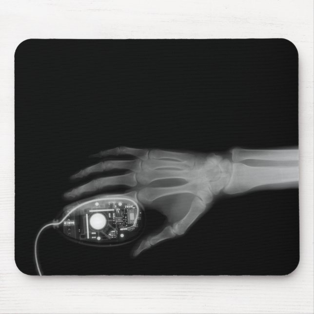 X-Ray Hand & Computer Mouse Pad (Front)