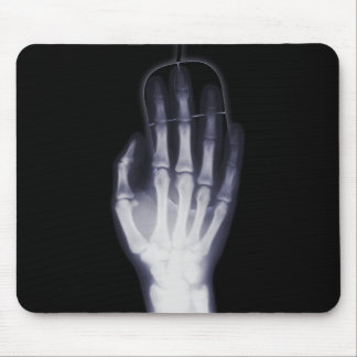 X-ray Hand Mouse Pad
