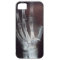 X Ray Hand Phone Case