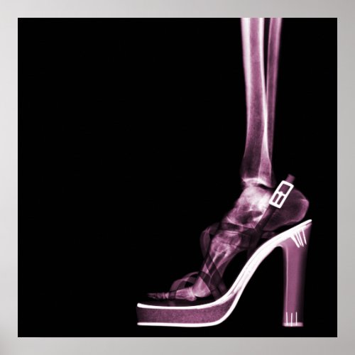 X_RAY HIGH HEEL LADY SKELETON FOOT PINK POSTER