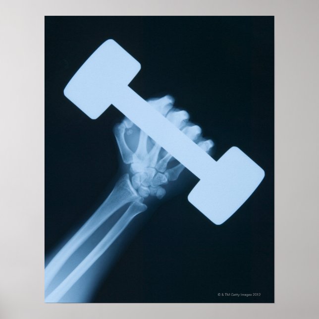 X-ray image of human hand with weight, close-up poster (Front)