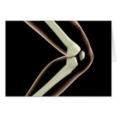 X-Ray Image Of Knee 1 (Front Horizontal)