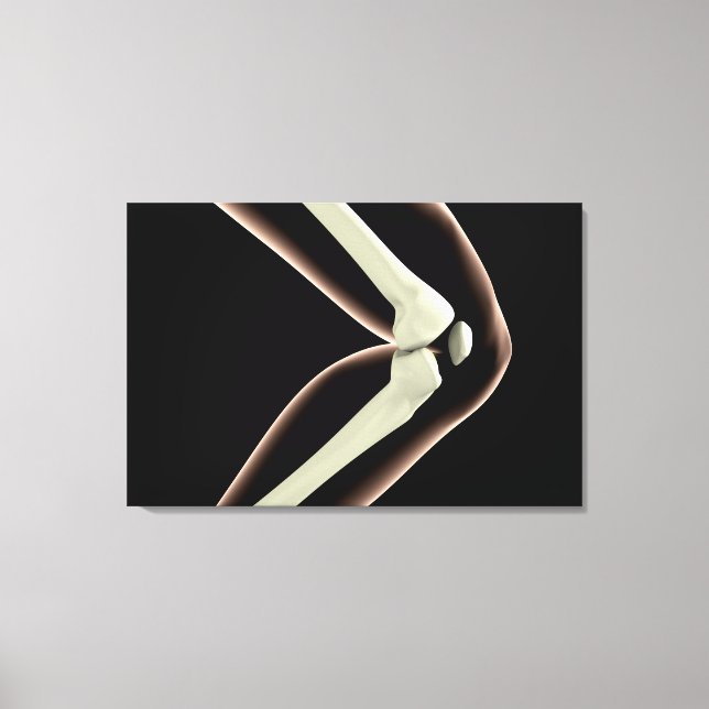 X-Ray Image Of Knee 1 Canvas Print (Front)