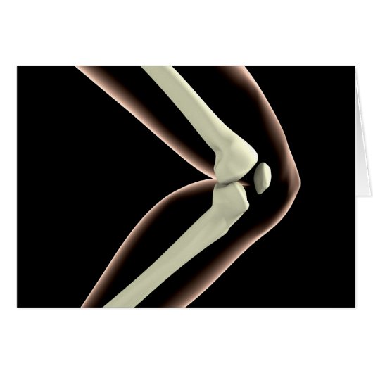 X-Ray Image Of Knee 1 Cards (Front Horizontal)