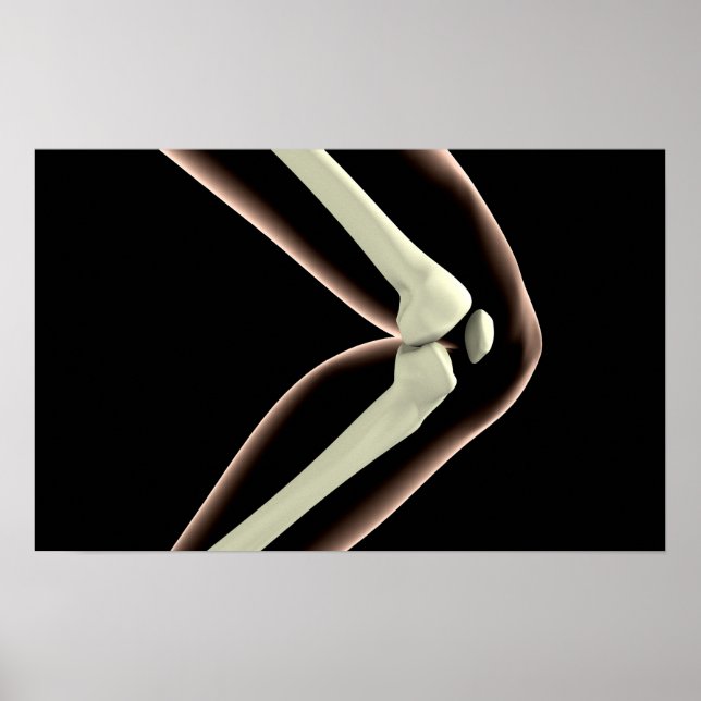 X-Ray Image Of Knee 1 Poster (Front)