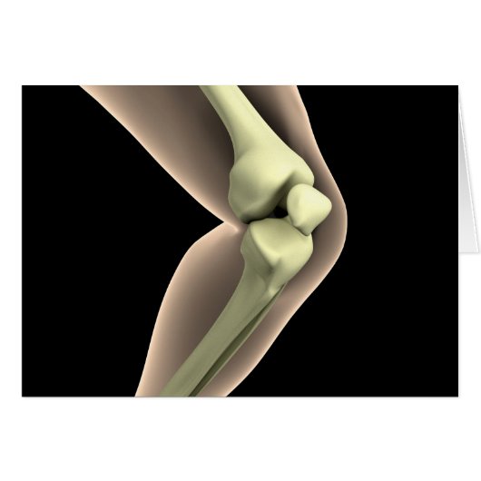 X-Ray Image Of Knee 2 Cards (Front Horizontal)