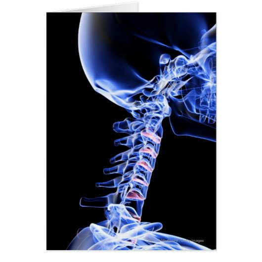 X-ray image of the bones of the neck cards (Front)