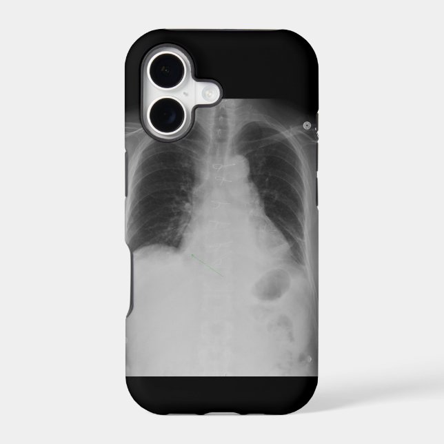 X Ray ~ iPhone 5 CaseMate case (Back)