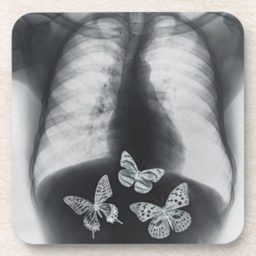 X_ray of butterflies in the stomach beverage coaster