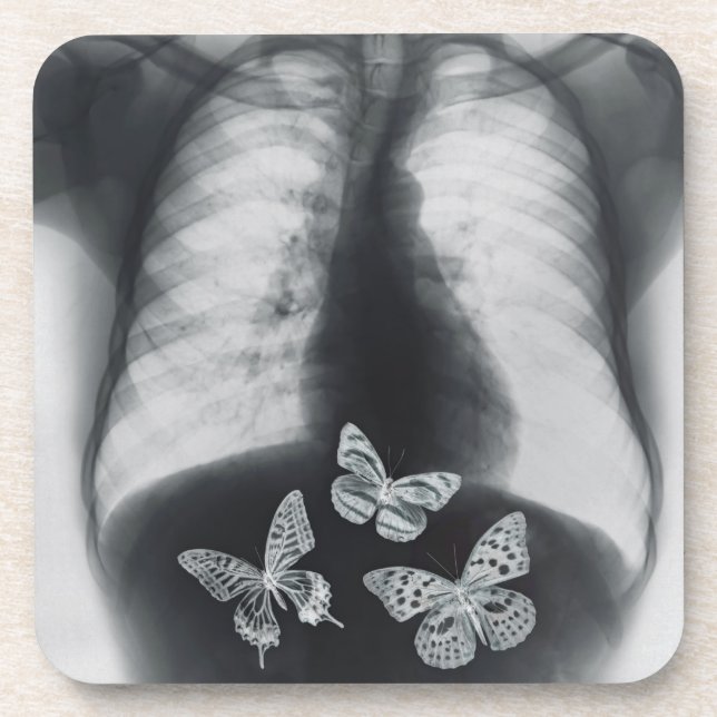 X-ray of butterflies in the stomach beverage coaster (Front)