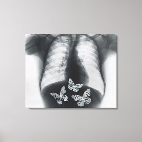X_ray of butterflies in the stomach canvas print