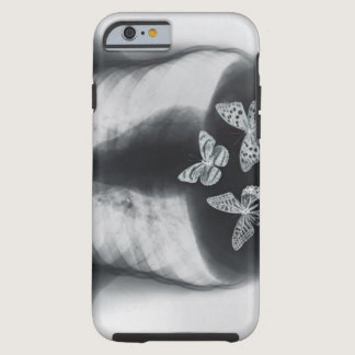 X-ray of butterflies in the stomach tough iPhone 6 case
