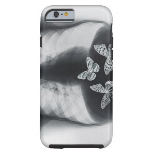 X_ray of butterflies in the stomach tough iPhone 6 case