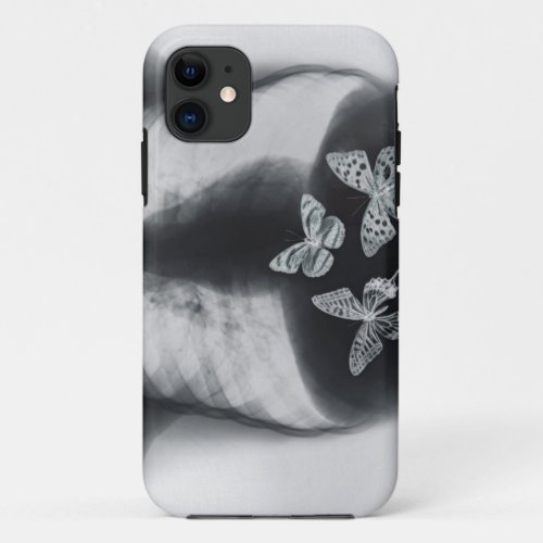 X_ray of butterflies in the stomach iPhone 11 case