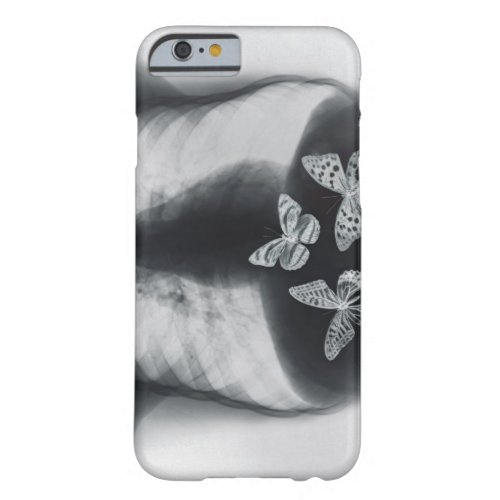 X_ray of butterflies in the stomach barely there iPhone 6 case