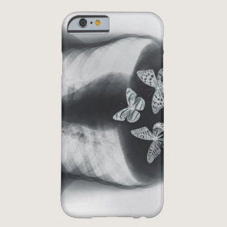 X-ray of butterflies in the stomach barely there iPhone 6 case