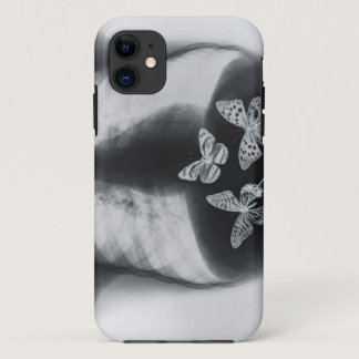 X-ray of butterflies in the stomach iPhone 11 case