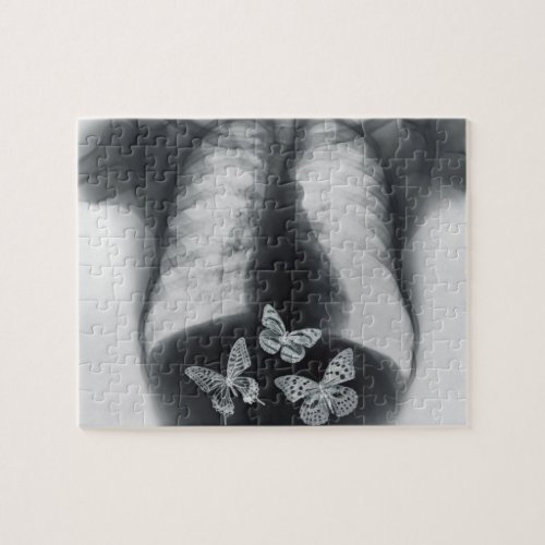 X_ray of butterflies in the stomach jigsaw puzzle