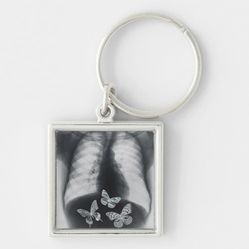 X_ray of butterflies in the stomach keychain