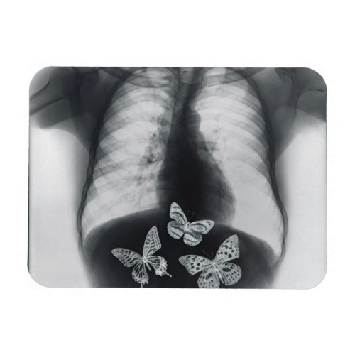 X_ray of butterflies in the stomach magnet