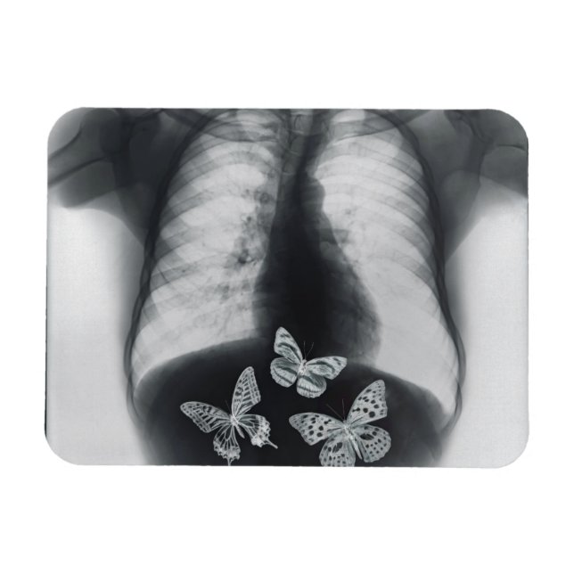 X-ray of butterflies in the stomach magnet (Horizontal)