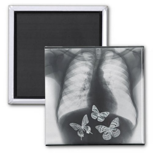 X_ray of butterflies in the stomach magnet