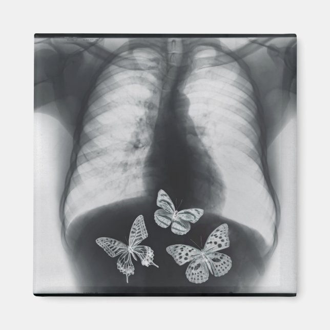X-ray of butterflies in the stomach magnet (Front)