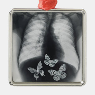 X-ray of butterflies in the stomach metal ornament