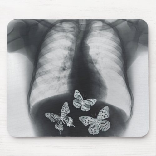 X_ray of butterflies in the stomach mouse pad