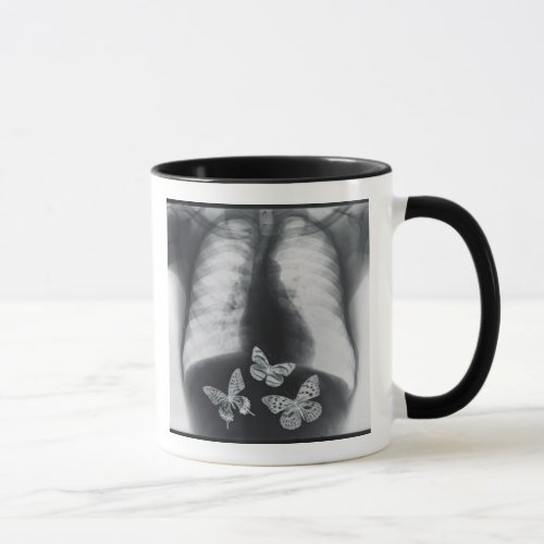 X_ray of butterflies in the stomach mug