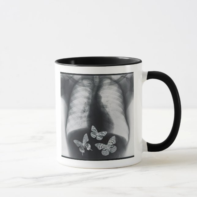 X-ray of butterflies in the stomach mug (Right)
