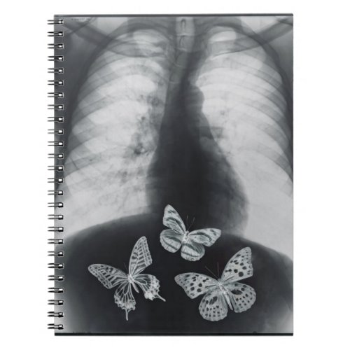 X_ray of butterflies in the stomach notebook