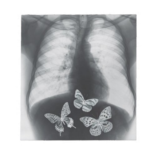 X_ray of butterflies in the stomach notepad