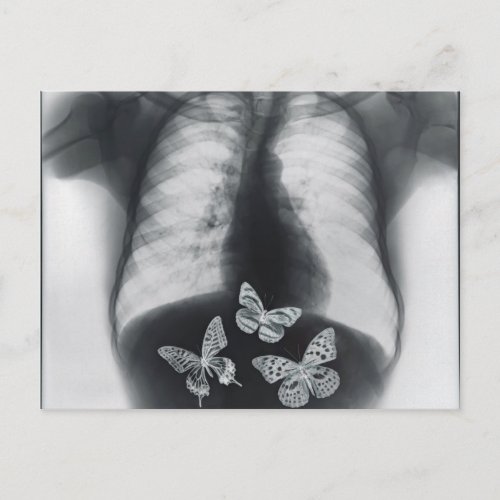 X_ray of butterflies in the stomach postcard
