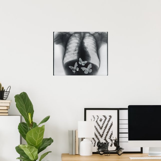 X-ray of butterflies in the stomach poster | Zazzle