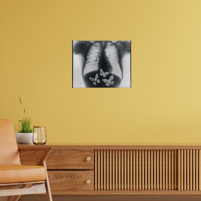 X-ray of butterflies in the stomach poster | Zazzle