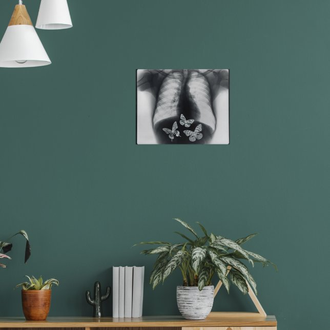 絵画 In my stomach X-ray of butterflies in the stomach poster | Zazzle