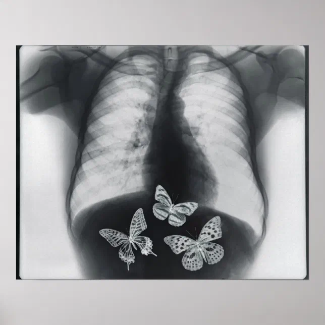 絵画 In my stomach X-ray of butterflies in the stomach poster | Zazzle
