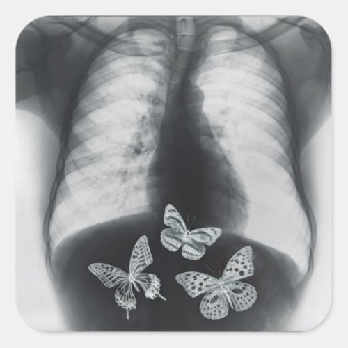 X_ray of butterflies in the stomach square sticker