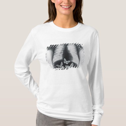 X_ray of butterflies in the stomach T_Shirt