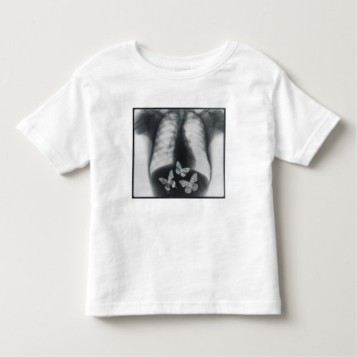 X_ray of butterflies in the stomach toddler t_shirt
