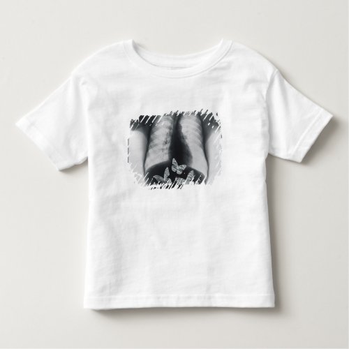 X_ray of butterflies in the stomach toddler t_shirt