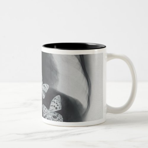 X_ray of butterflies in the stomach Two_Tone coffee mug