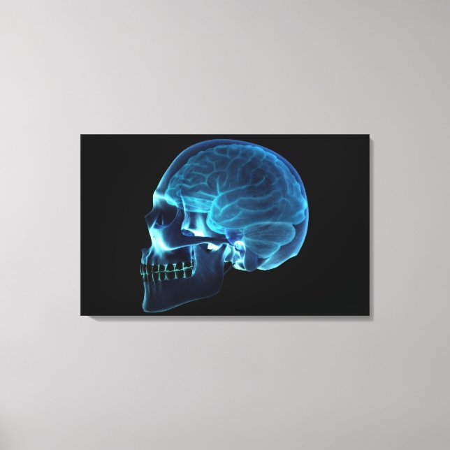 X-ray of the brain inside a skull canvas print (Front)